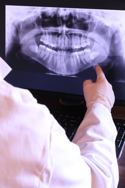Best Emergency Root Canal Treatment in Garden Grove, FL